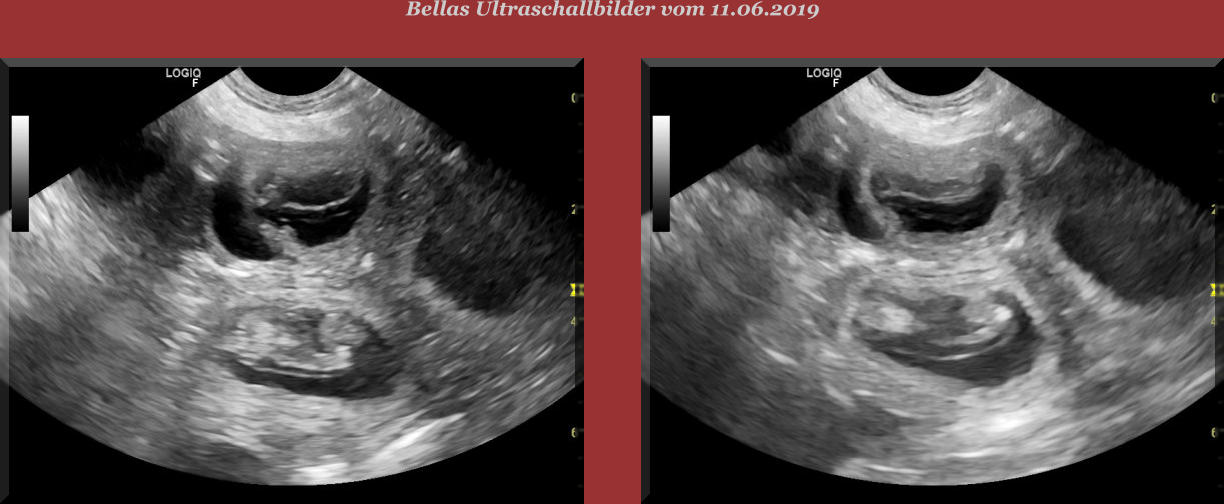 Bellas Ultraschallbilder vom 11.06.2019